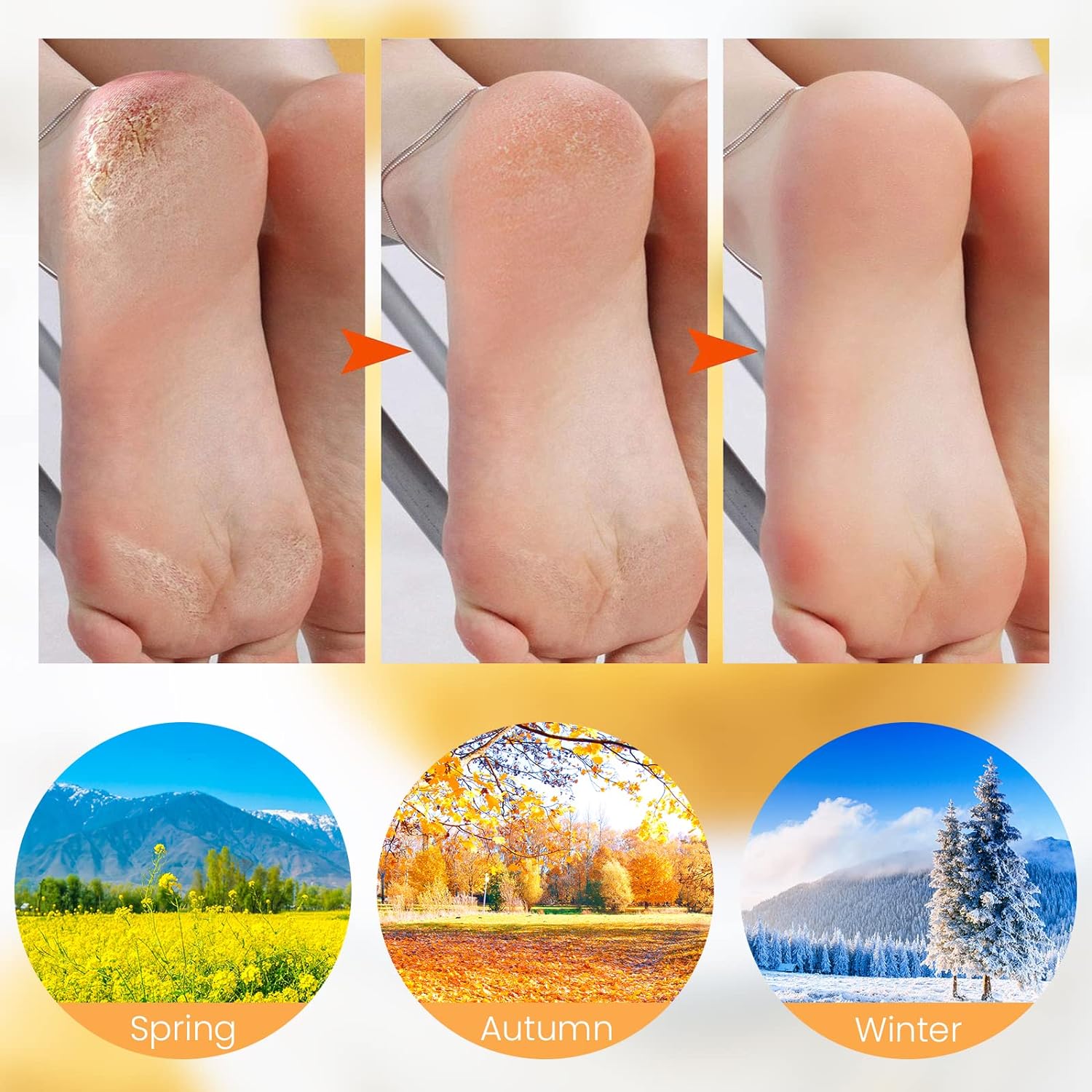 🥳2026 HOT SALE🥳💞50K+ SOLD!🦶✨ 50% OFF! Moisturizing Foot Mask Socks – Silicone gel locks in moisture, releases plant oils. Softens cracks & rough skin – wear with shoes for all‑day care! 🌿🧦